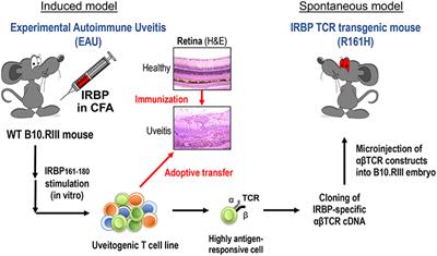 Microbiome and Autoimmune Uveitis